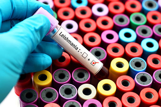 Mão de médico segura frasco de exame para detecção de leishmaniose