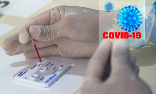 Monitora Covid 19