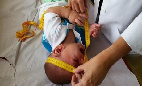 Foto: Agência Brasil Bebê tendo a cabeça medida por uma médica
