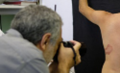 Imagem: Fareed Mirza/AI4Leprosy Fotógrafo tirando uma foto das costas de uma pessoa com sintomas de hanseníase