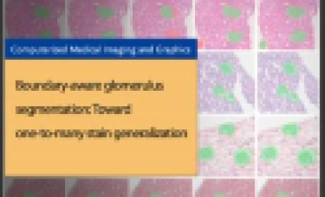 Estudo foi realizado com participação de pesquisadores da Fiocruz Bahia, Universidade Federal da Bahia e Universidade Estadual de Feira de Santana (Imagem: Fiocruz Bahia) Boundary-aware glomerulus segmentation: Toward one-to-many stain generalization