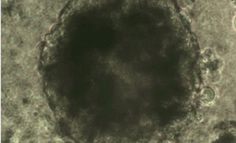 imagem de células cardíacas vistas em microscópio