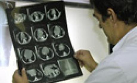 Considera-se doença rara aquela que afeta até 65 pessoas em cada 100.000 indivíduos (Foto: IFF) Foto de um médico analisando uma imagem tirada por raio-x