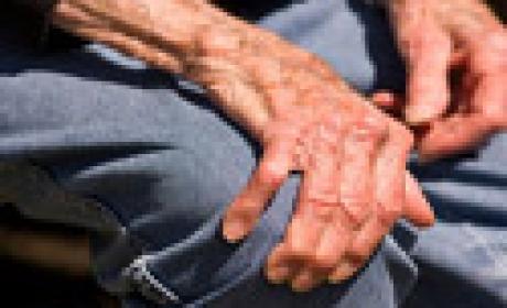 Foto: Acervo Claves/Fiocruz Detalhe de mãos de idoso sentado