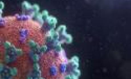 Imagem: divulgação Virus da Covid-19 visto pelo microscópio