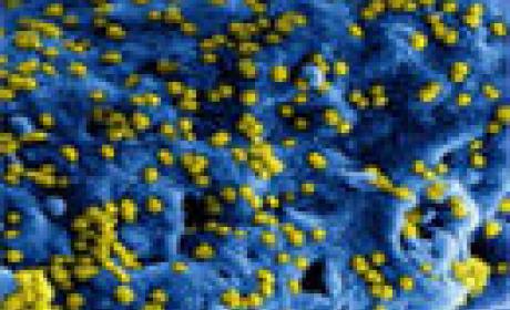 Imagem: divulgação Coronavírus visto por microscópio