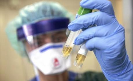 Imagem de um técnico de laboratório segurando uma amostra de exame