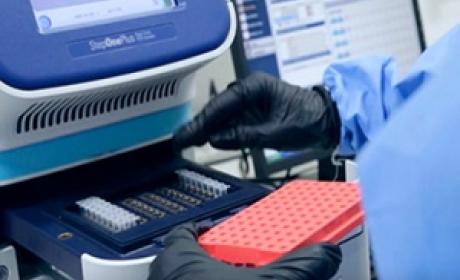 Foto: IOC/Fiocruz Pesquisador analisando o teste