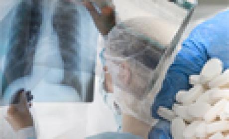 Imagem: Farmanguinhos Médico vendo o raio-x do pulmão de um paciente com tuberculose