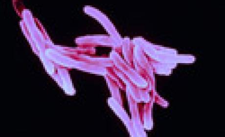 Mycobacterium tuberculosis (Foto: Acervo Ensp/Fiocruz) Mycobacterium tuberculosis