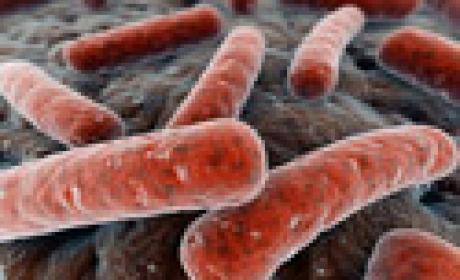Mycobacterium tuberculosis, causadora da tuberculose multirresistente (Foto: Acervo Agência Fiocruz de Notícias) Imagem de Mycobacterium tuberculosis, causadora da tuberculose multirresistente