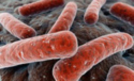 Imagem de Mycobacterium tuberculosis Imagem de Mycobacterium tuberculosis