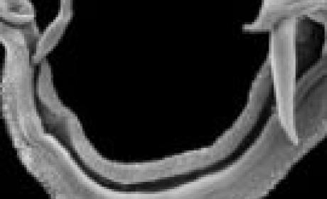 Imagem: Fiocruz Pernambuco Schistosoma mansoni visto por microscópio