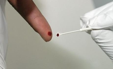 Pessoa fazendo teste de HIV/Aids
