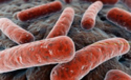 Microscopia eletrônica mostra o bacilo da tuberculose (Imagem: Acervo Agência Fiocruz de Notícias) Bacilos