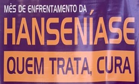 Imagem: Divulgação Imagem: Divulgação