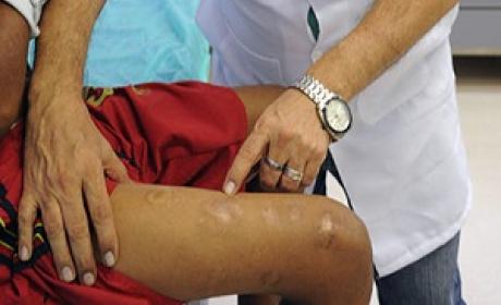 Foto: IOC/Fiocruz
