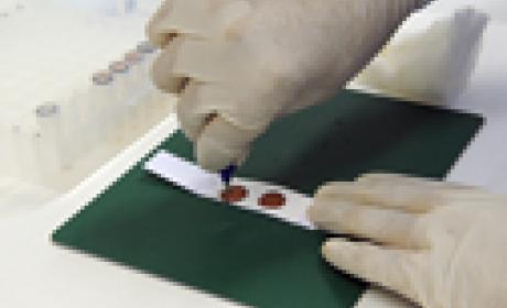 Foto: Gutemberg Brito / IOC / Fiocruz Detalhe de pesquisador colhendo amostras de sangue seco em uma lâmina