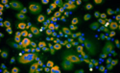 Microscopia de fluorescência mostra que os vírus Influenza H1N1 não conseguem penetrar no núcleo dos macrófagos infectados pelo HIV. Foto: Divulgação PLOS ONE Imagem de vírus em microscópio
