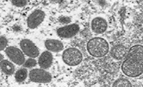 Imagem: CDC Vírus visto pelo microscópio
