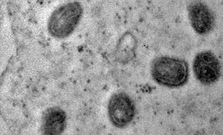 Vírus monkeypox visto pelo microscópio