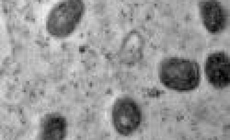 Image: IOC/Fiocruz