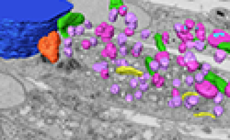 Animação apresenta reconstrução tridimensional da 'fábrica viral' em célula infectada pelo vírus mpox: 