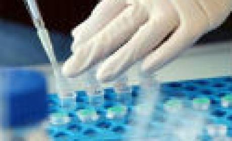 Imagem de pipetas em laboratório