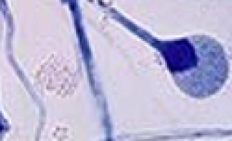 Imagem: INI Fungo visto pelo microscópio