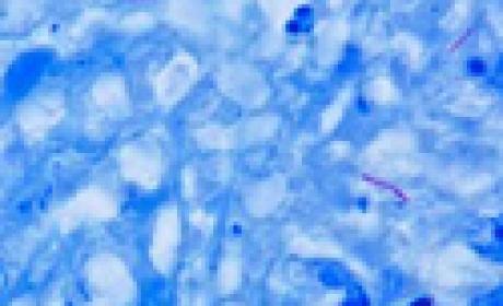 Reprodução Agência Fiocruz de Notícias Imagem microscópica do bacilo