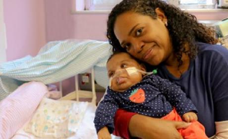 Mãe com bebê portador da microcefalia