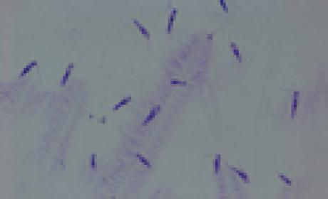 Imagem: Fiocruz Minas Leishmania braziliensis
