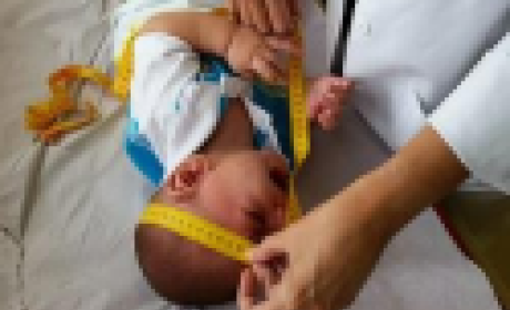 Foto: Rede Dengue Fiocruz Pediatra medindo a cabeça de um bebê
