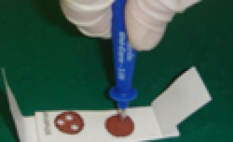 Papel de filtro usado como base para a amostra de sangue seco