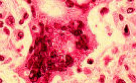 Imagem: Bio-Manguinhos Vírus causador do sarampo visto por microscópio