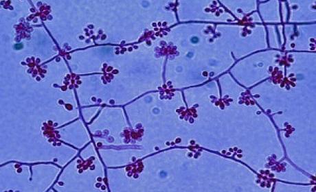 Foto: Universidade de Adelaide (Austrália) Vírus da esporotricose visto pelo microscópio