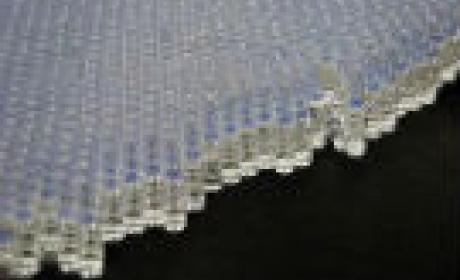 Imagem: Bio-Manguinhos Células vistas pelo microscópio
