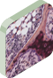     StateType Normal
